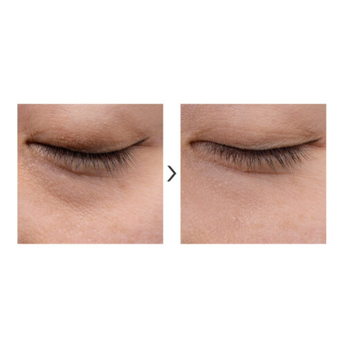 [Tiam] Vita A Bakuchiol Firming Eye Cream 30ml - Imagen 6